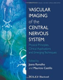 Vascular Imaging of the Central Nervous System: Physical Principles, Clinical Applications and Emerging Techniques (Current Clinical Imaging)