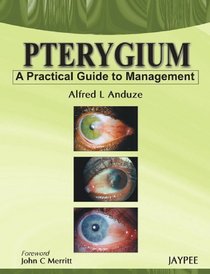 Pterygium - A Practical Guide to Management