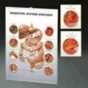 Digestive System Diseases: 3D Lenticular Chart