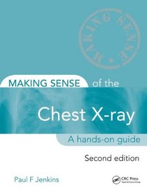 Making Sense of the Chest X-ray, Second Edition: A hands-on guide