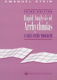 Rapid Analysis of Arrhythmias: A Self-Study Program