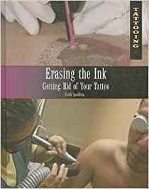 Erasing the Ink: Getting Rid of Your Tattoo (Tattooing)