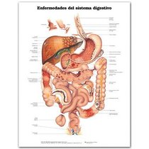 Diseases of the Digestive System Anatomical Chart in Spanish (Enfermedades del Sistema Digestivo)
