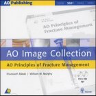 Ao Image Collection  Ao Principles Of Fracture Management (Ao Image Collection)