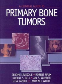 A Clinical Guide to Primary Bone Tumors