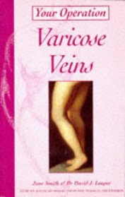 Varicose Veins (Your Operation S.)