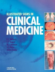 Illustrated Signs in Clinical Medicine