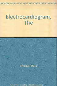 The Electrocardiogram