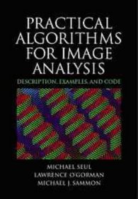 Practical Algorithms for Image Analysis: Descriptions, Examples, and Code