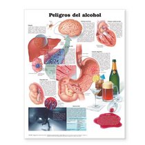 Dangers of Alcohol Anatomical Chart in Spanish (Peligros del alcohol)
