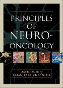 Principles and Practice of Neuro-Oncology
