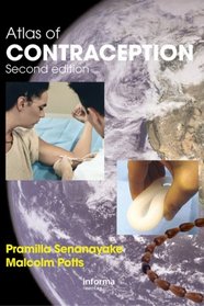 Atlas of Contraception: Second Edition (ENCYCLOPEDIA OF VISUAL MEDICINE SERIES)