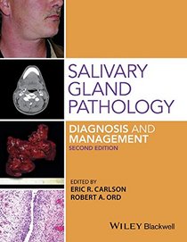 Salivary Gland Pathology Diagnosis and Management