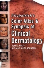 Fitzpatrick's Color Atlas and Synopsis of Clinical Dermatology: Sixth Edition (Fitzpatrick's Color Atlas & Synopsis of Clinical Dermatology)