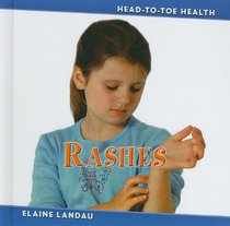 Rashes (Head-to-Toe Health 3)