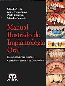 Manual Ilustrado de Implantologia Oral. Diagnostico, cirugia y protesis