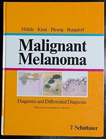 Malignant Melanoma: Diagnosis and Differential Diagnosis