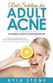 Real Solutions for Adult Acne: Cure Hormonal Acne with Science-Backed Treatments that Work