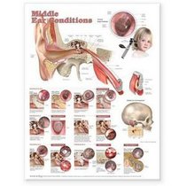Middle Ear Conditions Anatomical Chart (Anatomical Chart Company)
