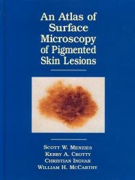 An Atlas of the Surface Microscopy of Pigmented Skin Tumors