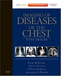 Imaging of Diseases of the Chest: Expert Consult - Online and Print