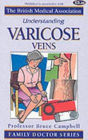 Understanding Varicose Veins (Family Doctor)