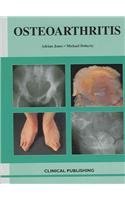 Oesteoarthritis: An Atlas of Investigation and Diagnosis