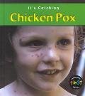 Chicken Pox (It's Catching)
