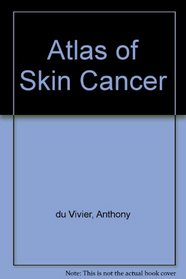 Atlas of Skin Cancer