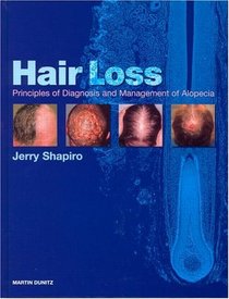 Hair Loss