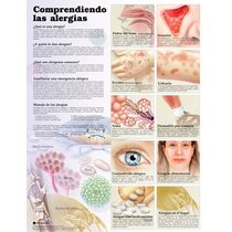 Understanding Allergies Anatomical Chart in Spanish (Entendiendo Las Alergias)