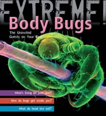 Extreme Science: Body Bugs!: The Uninvited Guests on Your Body (Extreme!)