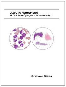 Adiva 120/2120i: A Guide to Cytogram Interpretation