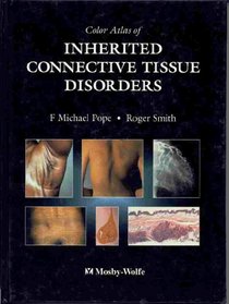 Color Atlas of Inherited Connective Tissue Disorders