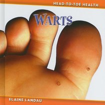 Warts (Head-to-Toe Health 3)