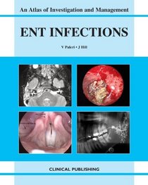 ENT Infections: An Atlas of Investigation and Management