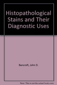 Histopathological Stains and Their Diagnostic Uses