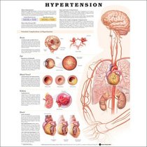 Hypertension Anatomical Chart