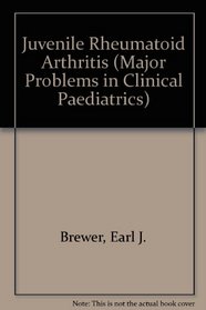 Juvenile Rheumatoid Arthritis (Major Problems in Clinical Paediatrics)