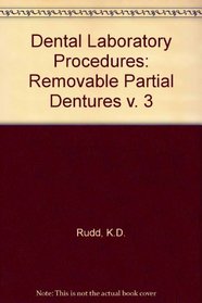 Dental Laboratory Procedures. Removable Partial Dentures, Volume 3