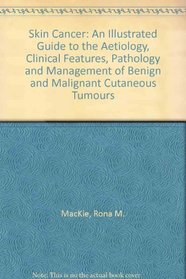 Skin Cancer: An Illustrated Guide to the Aetiology, Clinical Features, Pathology and Management of Benign and Malignant Cutaneous Tumours (Focal Points in Dermatology)