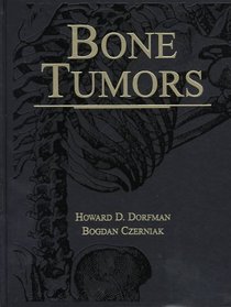 Bone Tumors