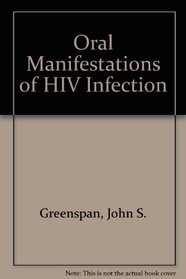 Oral Manifestations of HIV Infection