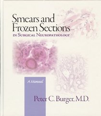 Smears and Frozen Sections in Surgical Neuropathology: A manual