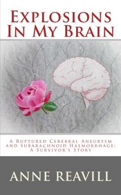 Explosions In My Brain: A ruptures cerebral aneurysm and subarachnoid haemorrhage; a surviver's story