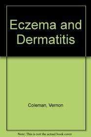 Dr V Colemans Eczema Dermatitis