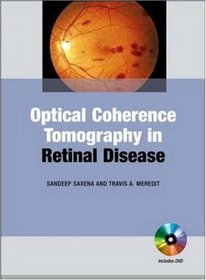 Optical Coherence Tomography in Retinal Disease