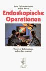 Endoskopische Operationen: Weniger Schmerzen, schneller gesund (German Edition)