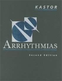 Arrhythmias