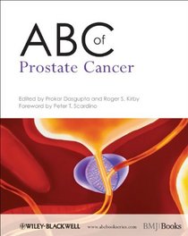 ABC of Prostate Cancer (ABC Series)